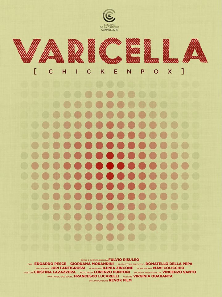 varicella